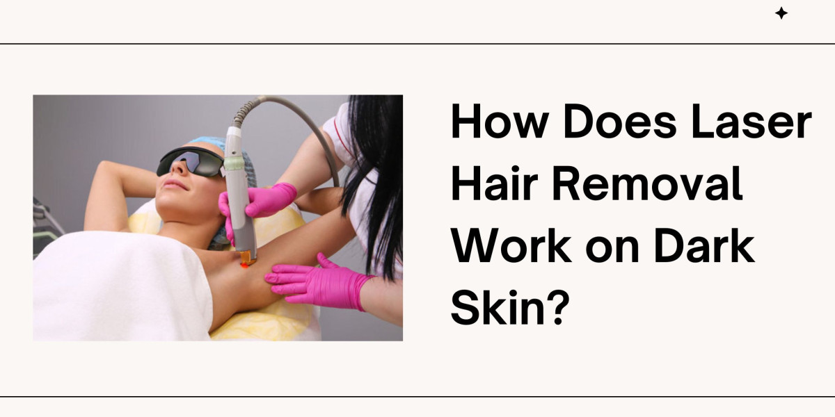 How Does Laser Hair Removal Work on Dark Skin?